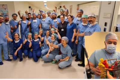 Turkish Medical Team Separates Conjoined Twins in 9 Hours, Breaking World Record